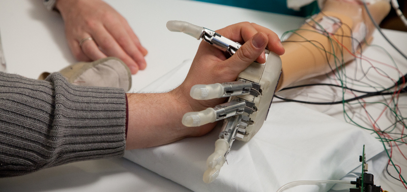 Illustration for article titled This cybernetic hand is the first to give amputees a sense of touch